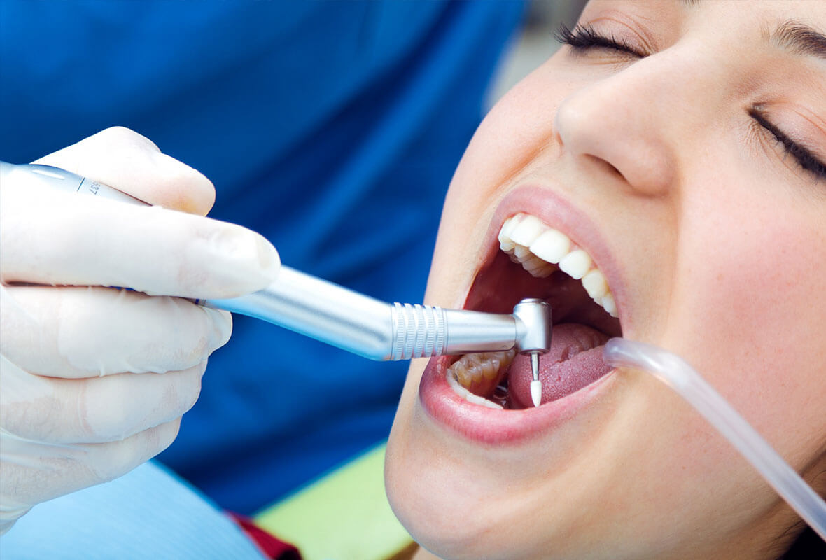 Understanding the Benefits of Fluoride Treatment